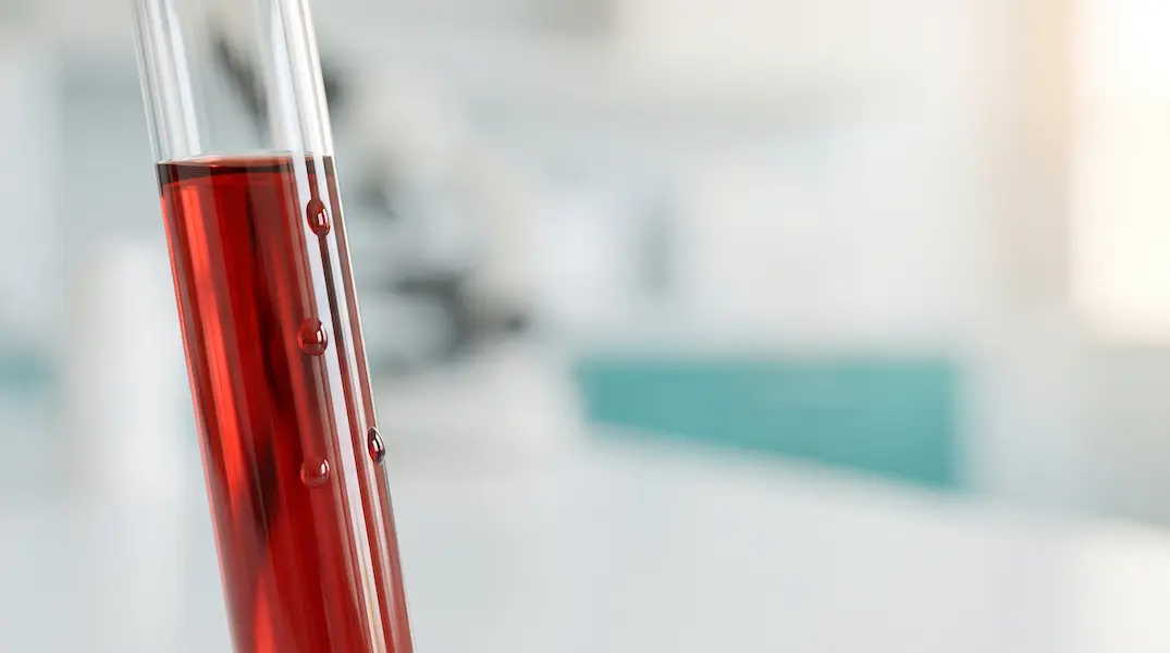 Lipoproteína(a) alta: qué es y qué significa tenerla elevada